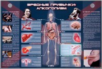 Электрифицированный стенд "Вредные привычки: алкоголизм" - fgospostavki.ru - Югорск