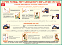 Таблица "Порядок действий при опасном кровотечении" (100х140 сантиметров, винил) - fgospostavki.ru - Югорск