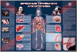 Электрифицированный стенд "Вредные привычки: алкоголизм" - fgospostavki.ru - Югорск