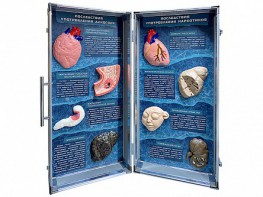 Учебно-демонстрационный кейс "Последствия употребления алкоголя и наркотиков" - fgospostavki.ru - Югорск