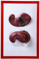 Барельефная модель "Печень" - fgospostavki.ru - Югорск